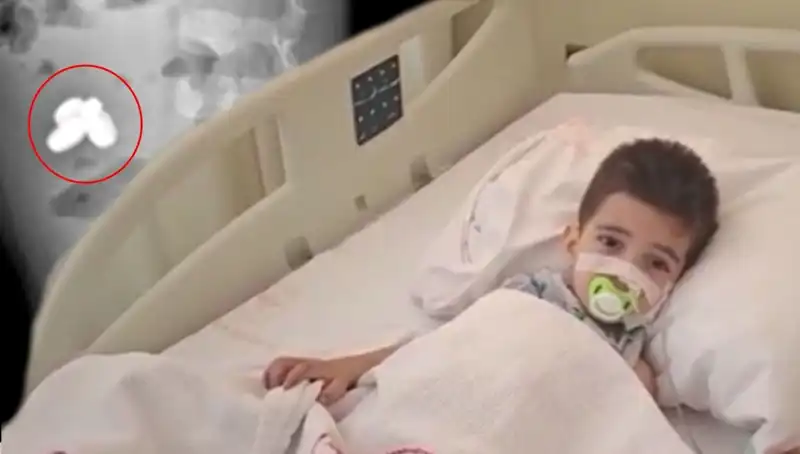 Pil ve Mıknatıs Yutan Çocuk Hayati Tehlike Geçirdi: Bir Dramın Hikayesi