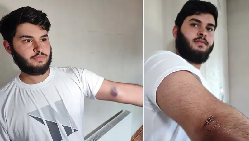 Bahçeye Kaçan Top, Mahallede Kaos Yarattı: "Conolar Kamyonetle Geldi!"