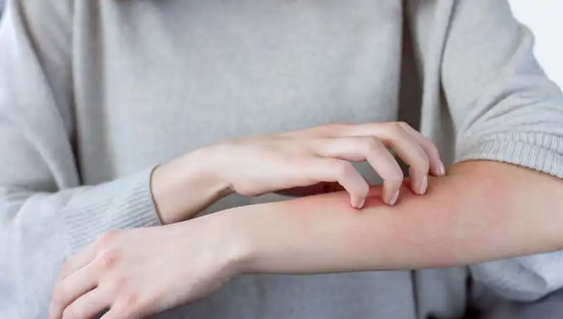 Cilt Kanserinin Gözden Kaçırılan İki Belirtisi: Dermatologdan Önemli Açıklamalar